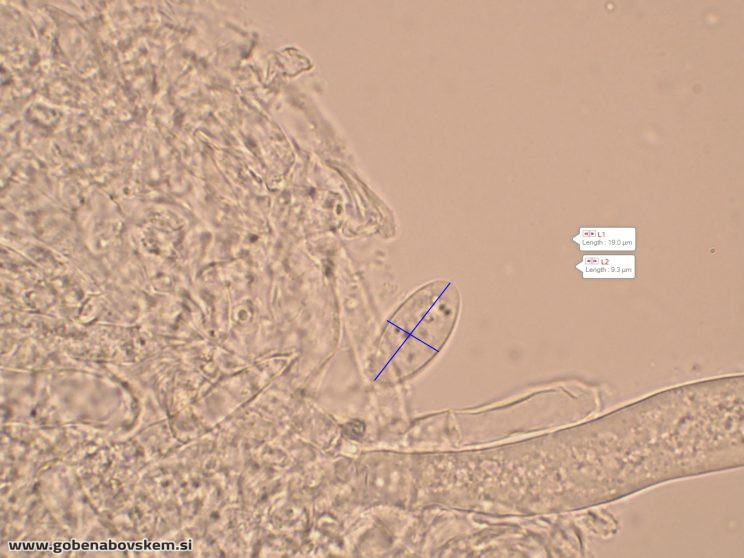 DISCIOTIS VENOSA UŠJE 17 3 26 2