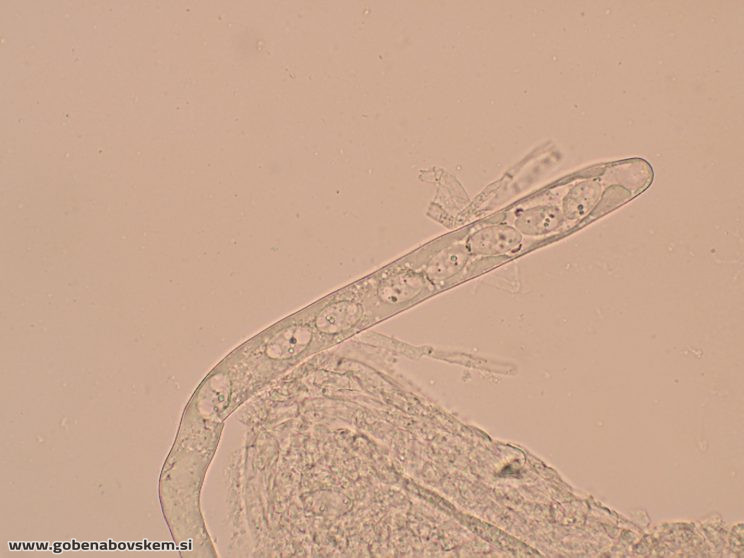 DISCIOTIS VENOSA UŠJE 17 3 26 4