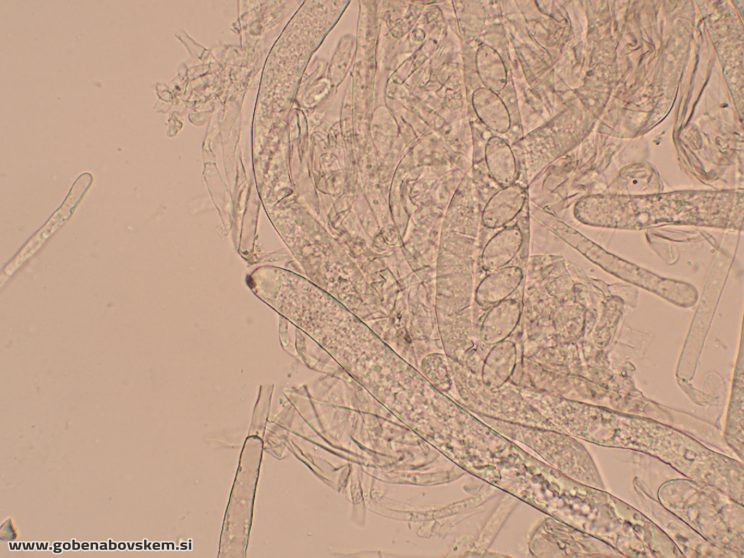 DISCIOTIS VENOSA UŠJE 17 3 26 5