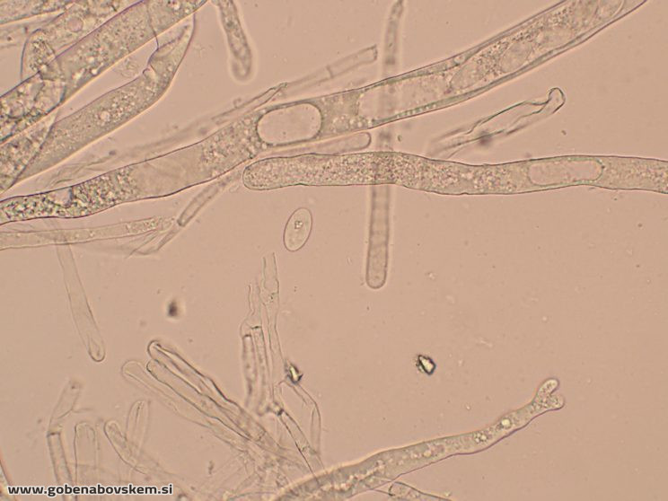 DISCIOTIS VENOSA UŠJE 17 3 26 6