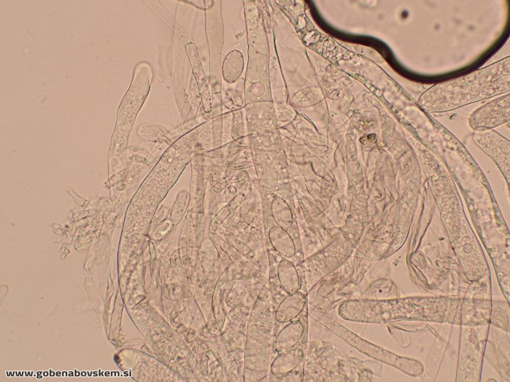 DISCIOTIS VENOSA UŠJE 17 3 26 7