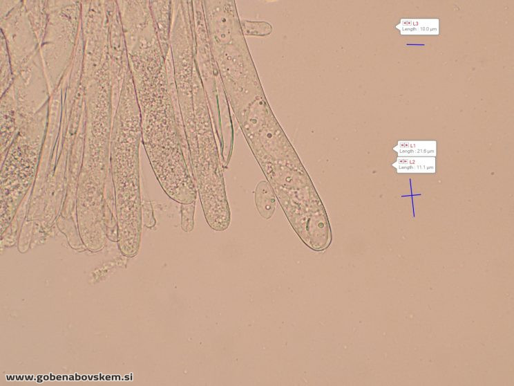 DISCIOTIS VENOSA UŠJE 17 3 26