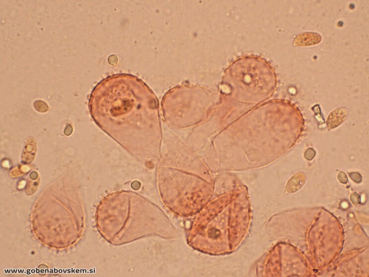 MYCENA CF METATA CHEILO 9 11 GOLF3