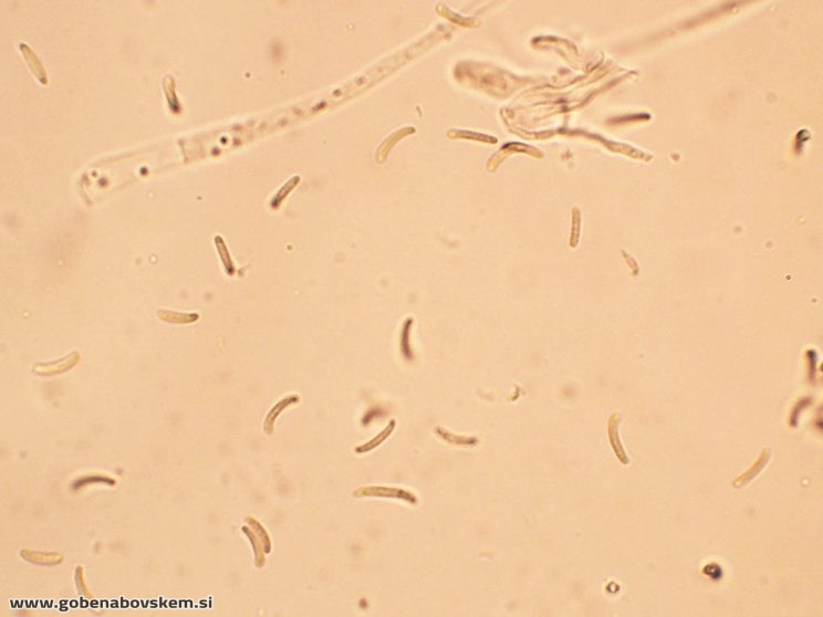 DIATRYPELLA FAVACEA RABELK 3 3 26 33