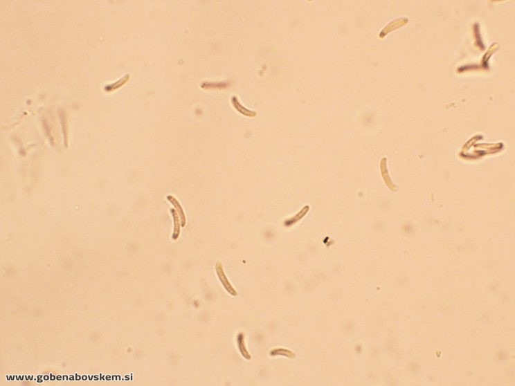 DIATRYPELLA FAVACEA RABELK 3 3 26 44