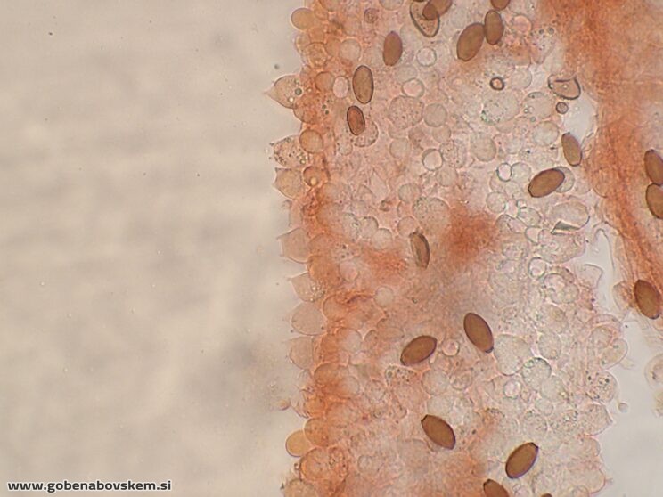 CONOCYBE MACROSPORA BAZIDIJ5