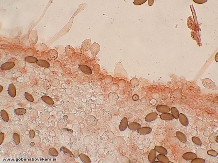 CONOCYBE MACROSPORA BAZIDIJ6