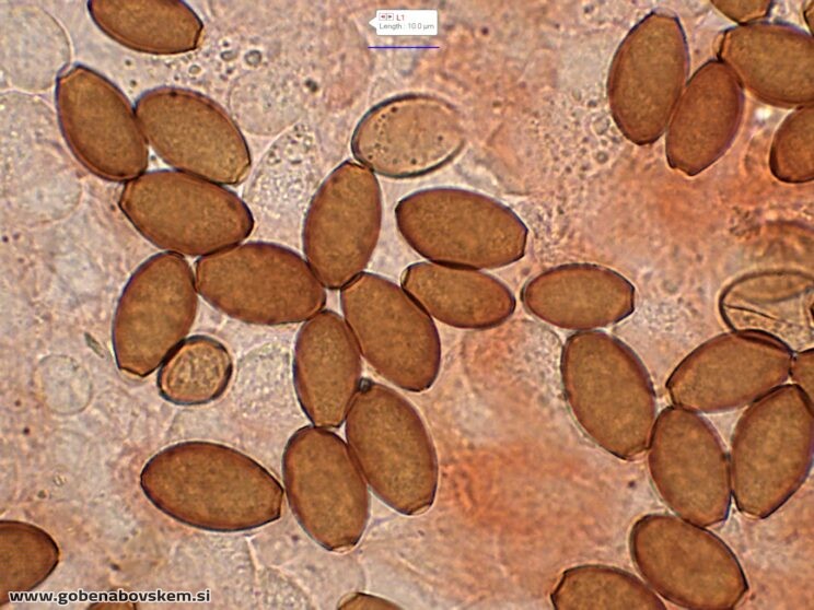 CONOCYBE MACROSPORA SPORE2