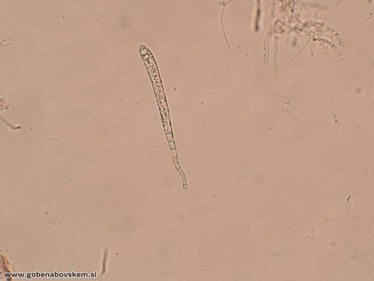 BISPORELLA CITRINA MANGRT DNA (11)