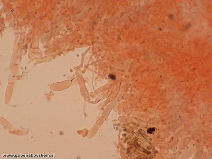 SPODOCYBE TRULIFORMIS HOLMSKI 10 10 26 4