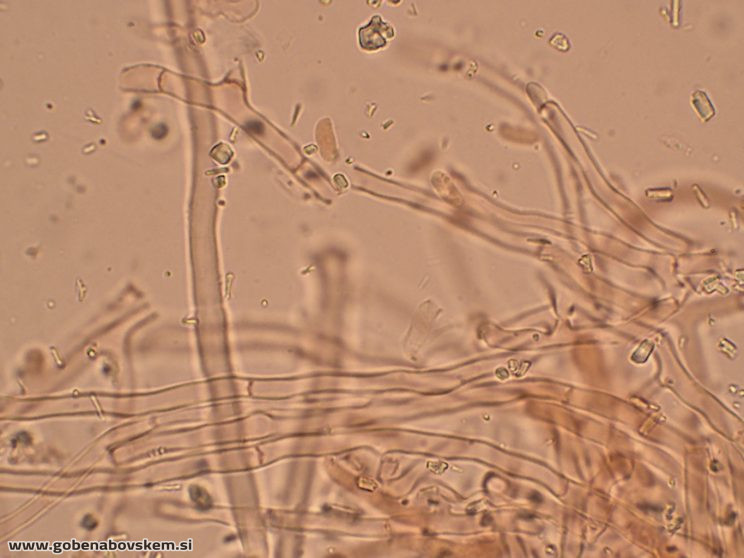 Byssomerulius corium (13)