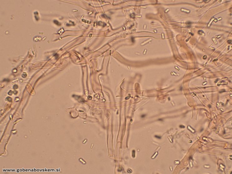 Byssomerulius corium (15)