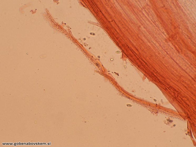 MYCENA CF METATA CHAULO2 9 11 GOLF