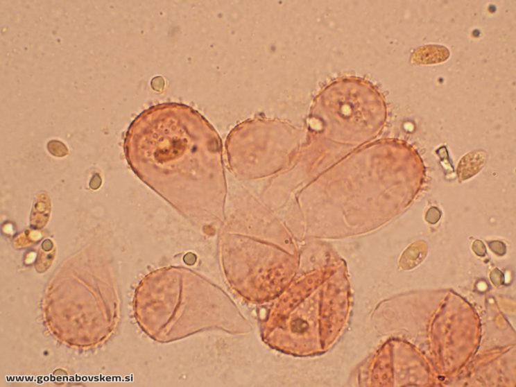 MYCENA CF METATA CHEILO 9 11 GOLF3
