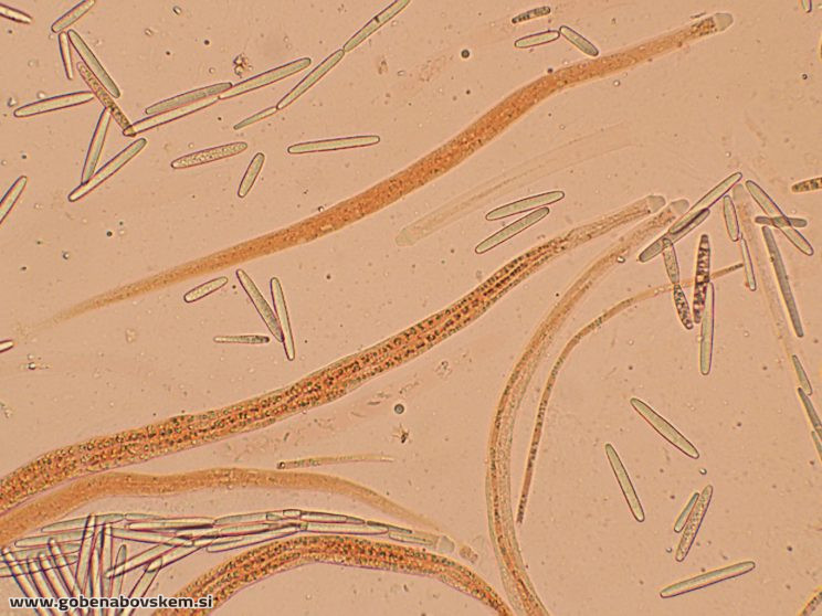 TOLYPOCLADIUM CAPITATA HOLMSKI 19 10 26 26