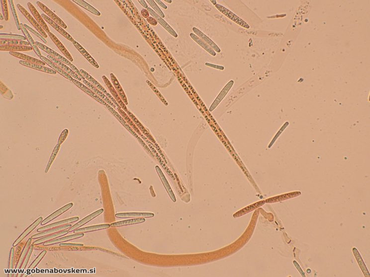 TOLYPOCLADIUM CAPITATA HUMSKI 19 10 26 26A