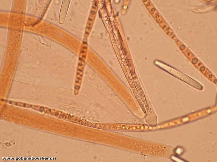 TOLYPOCLADIUM CAPITATA HUMSKI 19 10 26 72