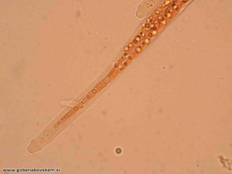 TOLYPOCLADIUM CAPITATUM HUMSKI 19 10 79