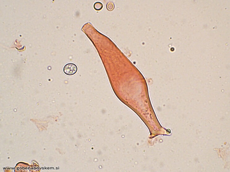 PLUTEUS PETASATUS PLEURO6