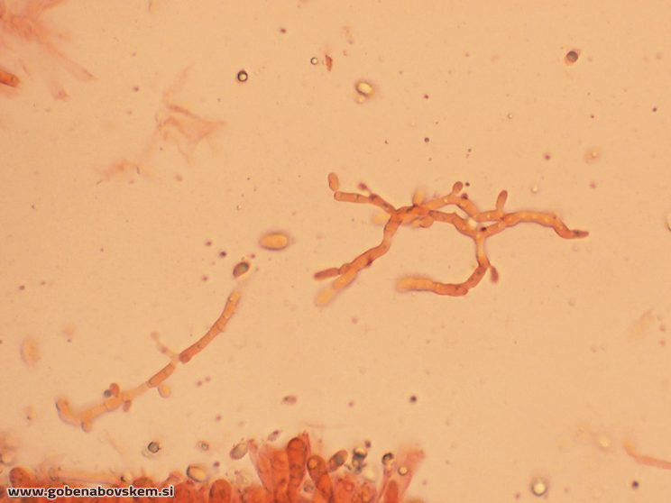 MYCENA AETITES PP VRSNIK