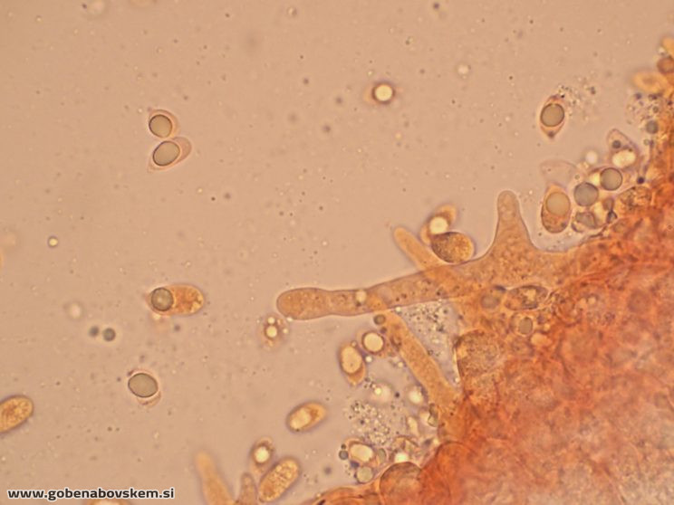 MYCENA AETITES PP VRSNIK2