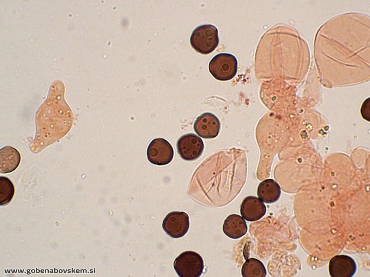 COPRINOPSIS CORDISPORUS CHEILO3