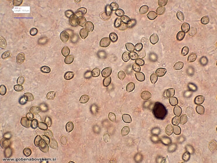 DECONICA CROBULA SPORE2