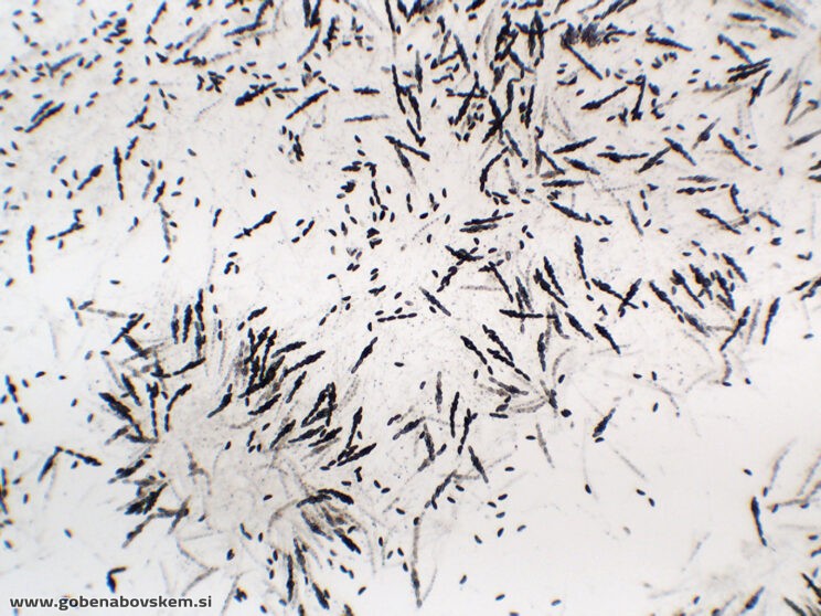 XYLARIA LONGIPES6