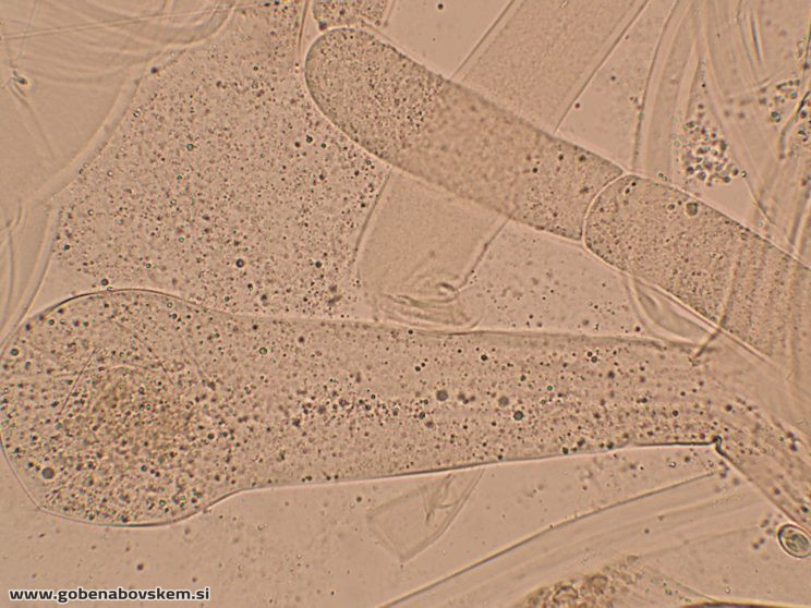 SYZYGYTES MEGALOCARPUS2