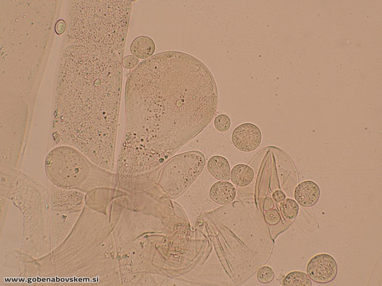 SYZYGYTES MEGALOCARPUS3