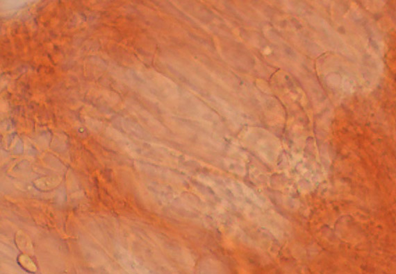 LYOPHYLUM collybia trama listicev lepena crop