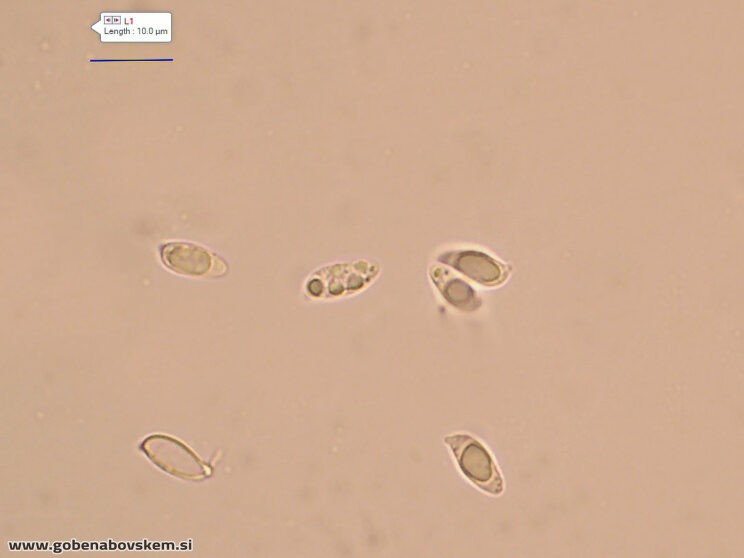 ATRACTOSPOROCYBE INORNATA4