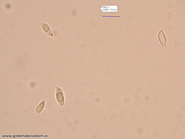 ATRACTOSPOROCYBE INORNATA5