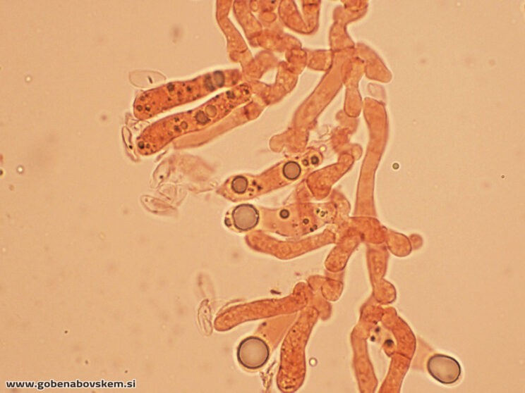 ATRACTOSPOROCYBE INORNATA7