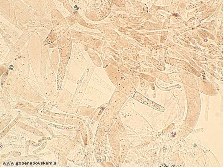ENTOLOMA UNDULATOSPORUM11