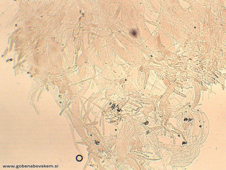 ENTOLOMA UNDULATOSPORUM13
