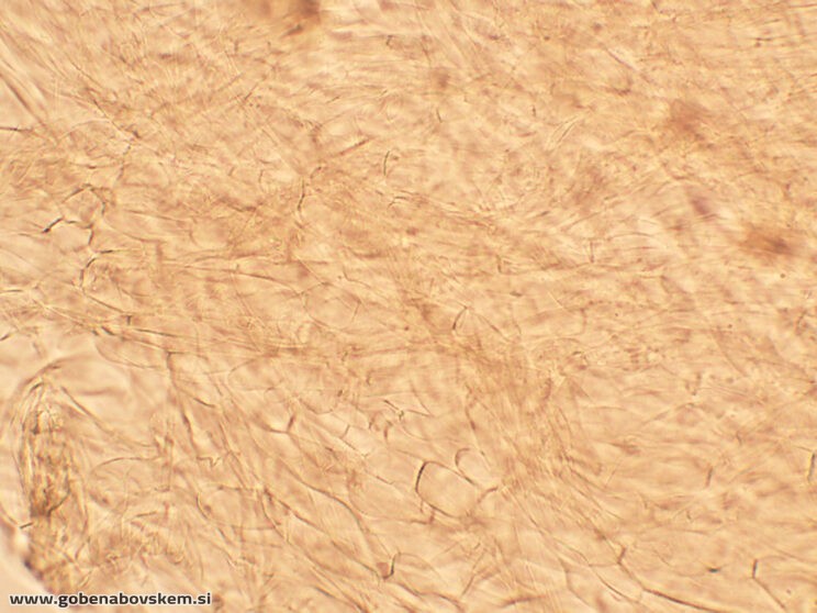 LYOPHYLLUM FIBROSIPES GOLF (1)