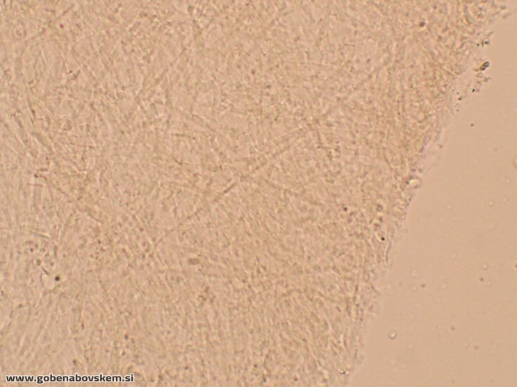 LYOPHYLLUM FIBROSIPES GOLF (14)