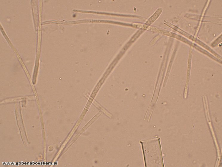 RUTSTROEMIA FIRMA (22)