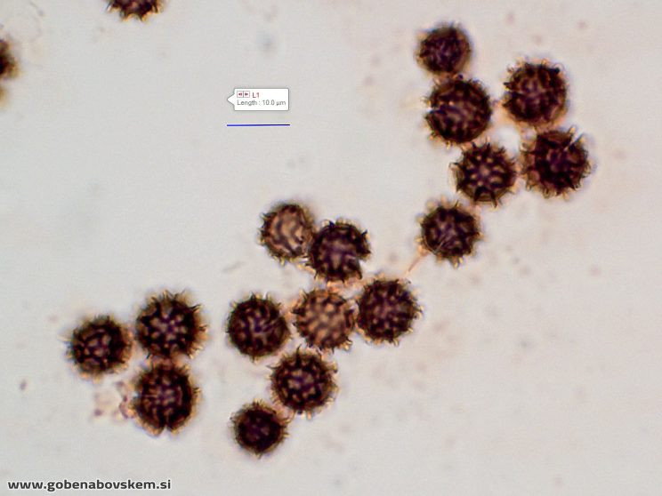 SCLERODERMA BOVISTA ANA4