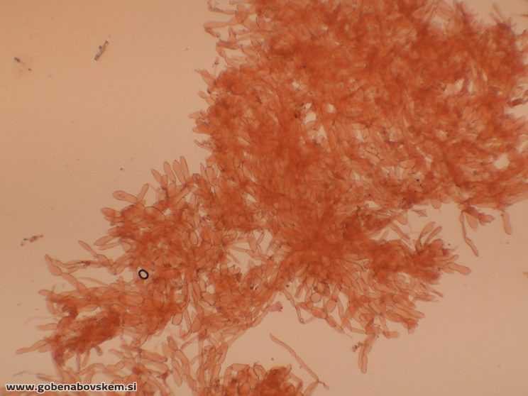 PSEUDOPORPOLOMA PES CAPRAE10
