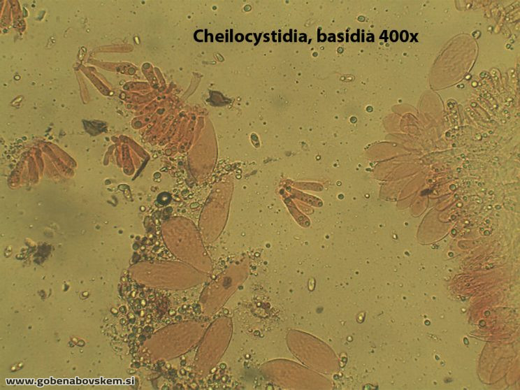MYCENA ABRAMSII CHEILO BASIDIA 400X
